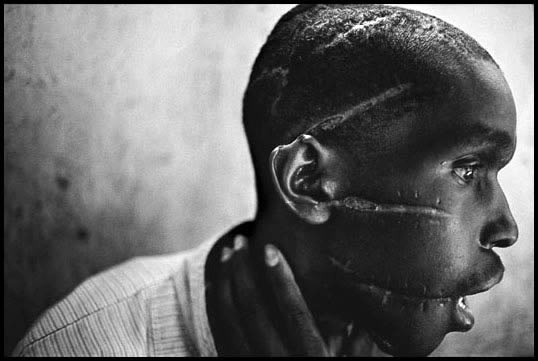 Male survivor of Rwandan Genocide